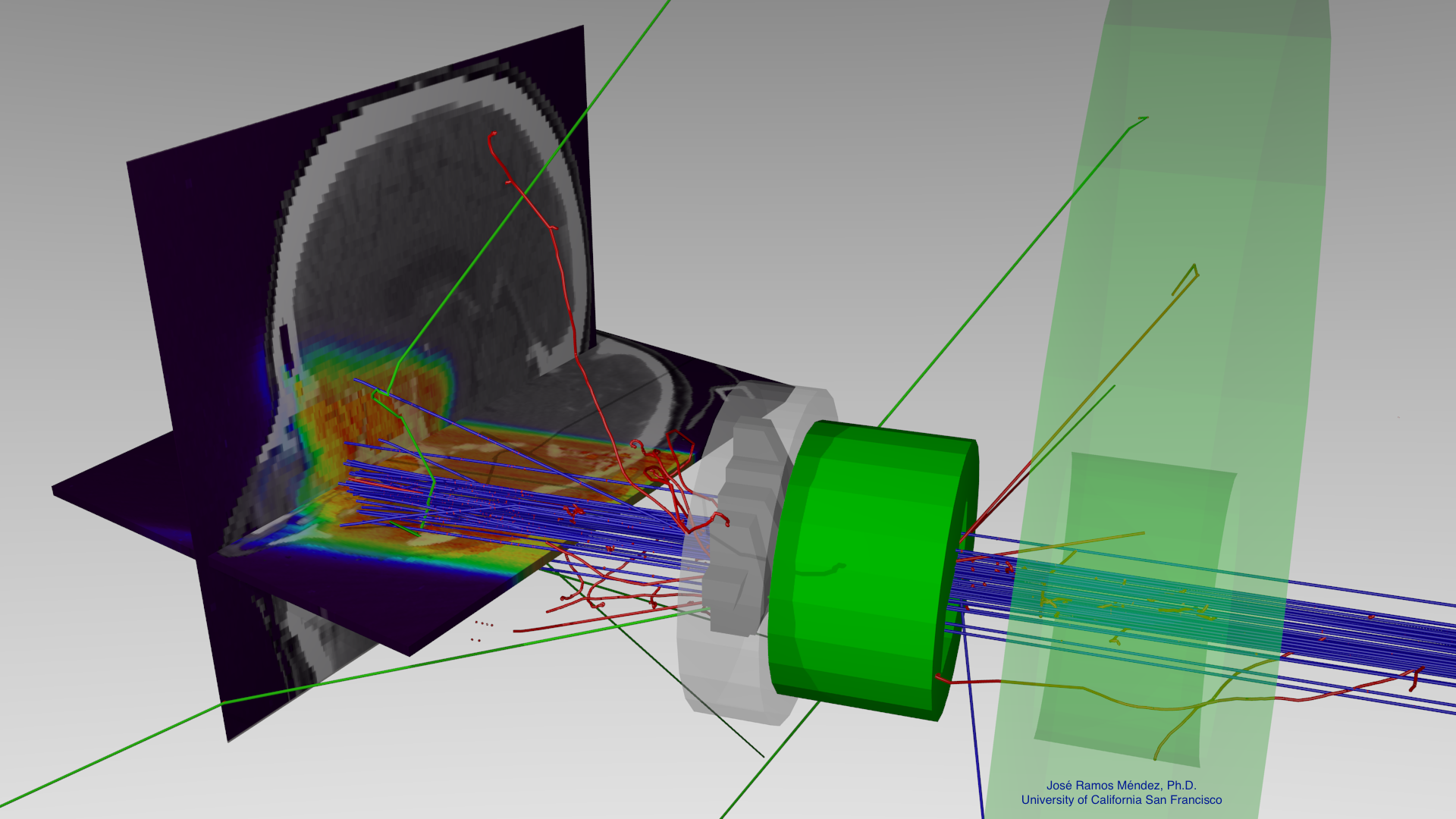 Radiotherapy